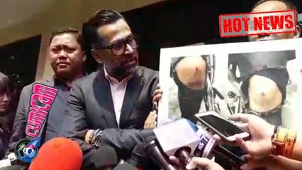 Miris, Putra Jeremy Thomas Ternyata Juga Dirampok - Cumicam 17 Juli 2017