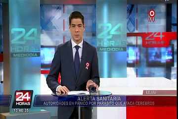 San Isidro: vecino insulta y golpea a sereno en parque El Olivar