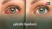 عشان تحمى عينيكى..5 إرشادات آمنة لاستخدام العدسات اللاصقة