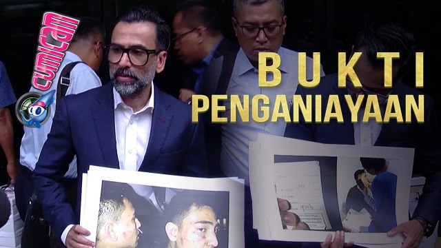 Jeremy Thomas Ungkap Bukti Penganiayaan Hebat atas Putranya - Cumicam 18 Juli 2017