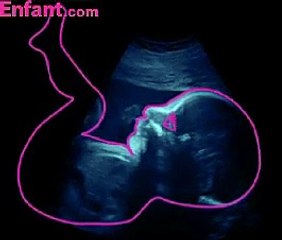 Voyage in utero - le 6e mois