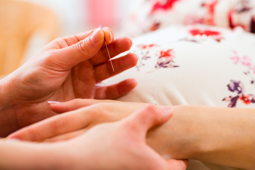 Acupuncture et grossesse