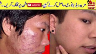 Beauty Tips In Urdu || Remedy To Remove Dark Spots Pigmentation