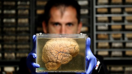 This Giant Brain Collection Could Help Treat Diseases