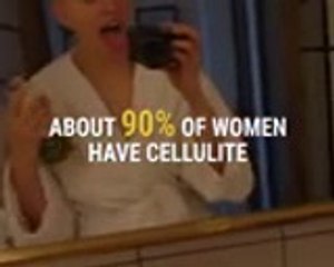 #CelluliteSaturday Is The Instagram Trend Everyone Need | entertainment alert |