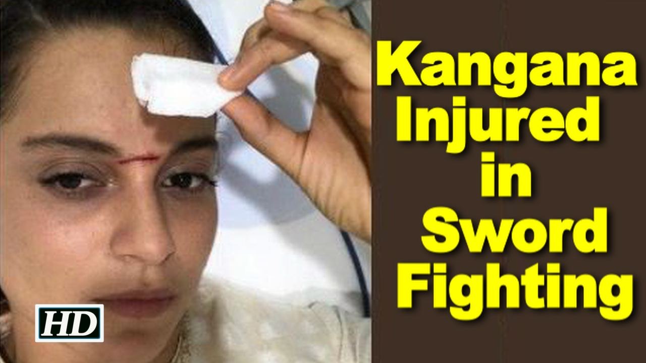 Kangana Injured on "Manikarnika” set in Sword fighting