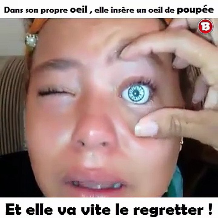 Dans son propre oeil , elle insère un oeil de poupée… Et elle va vite le regretter !