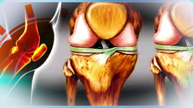 ME LO DIJO YOLY ALIMENTOS PARA LA OSTEOPOROSIS