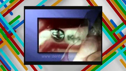 Dientes de leche