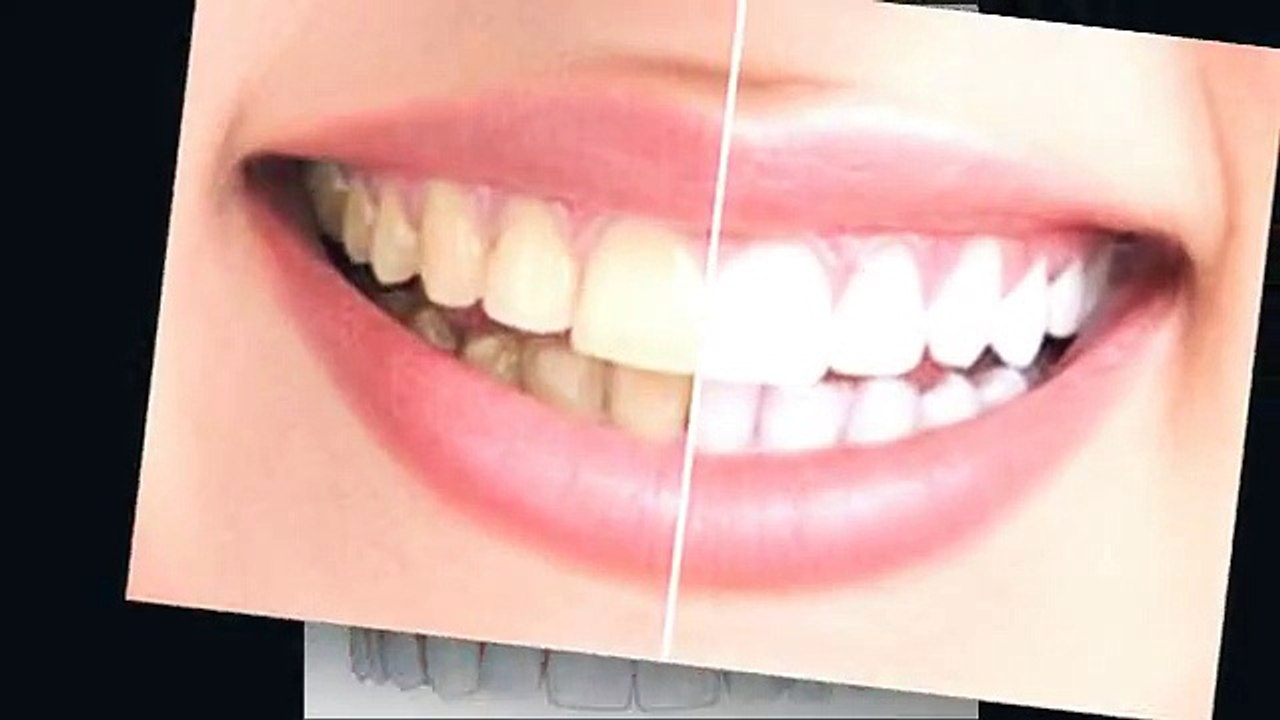 Burnaby Square Dental - pediatric dentist burnaby - burnaby dental clinic