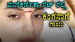 Kangana Ranaut Gets Forehead Injury On Sets Of 'Manikarnika'  | Filmibeat Kannada