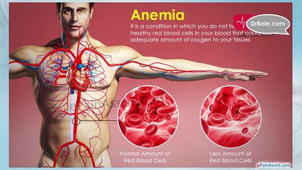 आंखों के नीचे काले गडढे या डार्क सर्कल से कैसे पाएं निजात