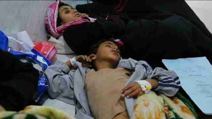 Muchas áreas del Yemen están a un paso de sufrir hambruna