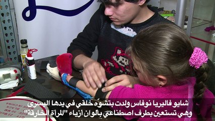 أطراف اصطناعية للأطفال بألوان أبطالهم المفضلين