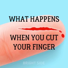 Bright Side - A vivid explanation of the healing process....