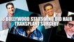 || Top 10 Bollywood Actors Who Went For Hair Transplant Surgery - Shocking! | Top Bollywood Information ||