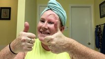 Atteinte d'un cancer rare sur le front, elle partage ses photos chocs à la télé US