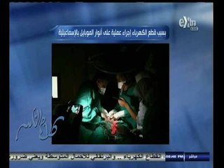 #كلام_الناس | بسبب قطع الكهرباء إجراء عملية على أنوار الموبايل بالإسماعيلية