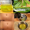 How To Remove Stretch Marks Permanently Works... - Simple Beauty Secrets(1080p)