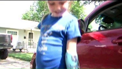 Fan With Kansas City Royals-Themed Prosthetic Gets Chance to Meet Team