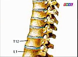 Thoái hóa đốt sống cổ - Sức khỏe của bạn - THVL