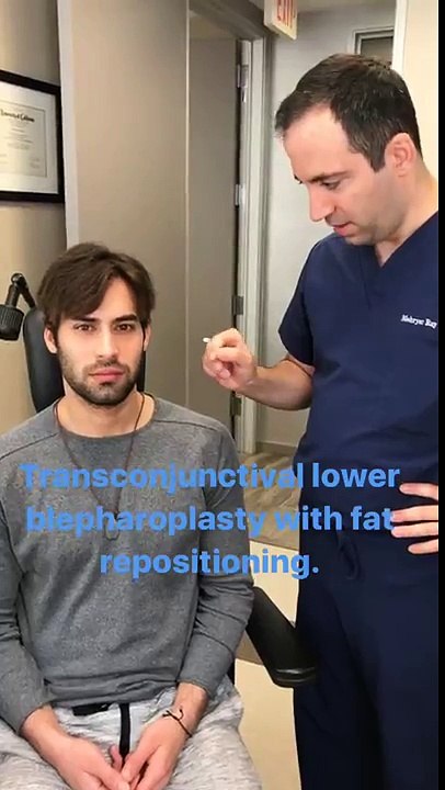 Blepharoplasty(Eyelid Lift Surgery) - Dr. Taban MD