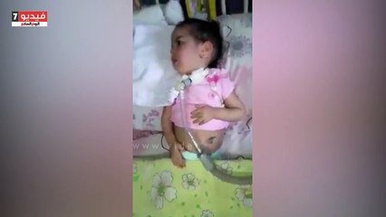 "خديجة" تعانى من شلل الأعصاب ووالدتها تطالب بعلاجها فى الخارج