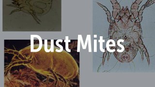 Get Rid of Dust mites by MattressKleen System Bed Cleaning Services