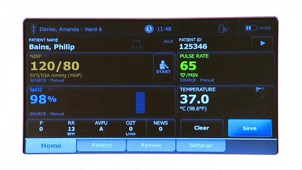 Welch Allyn Connex® Spot Monitor Demo