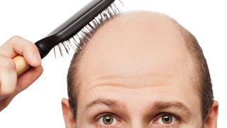 Your Lost Hair Can be Regrown in Days - Try This Simply Remedy