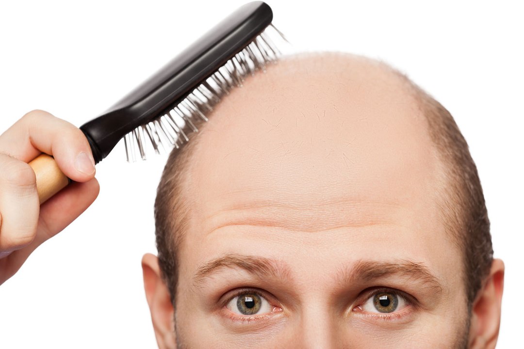 Your Lost Hair Can be Regrown in Days - Try This Simply Remedy