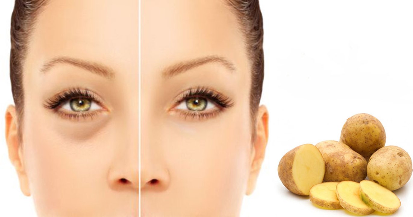 How to Use Potato for Dark Circles