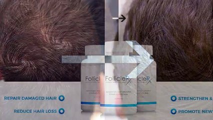 Follicle Rx South Africa Review