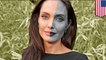 Angelina Jolie's rare facial paralysis explained
