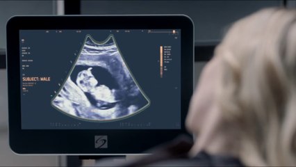 HD Online | Zoo Season 3 Episode 6 - Oz Is Oz