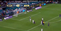 Lionel Messi Gets Injured - PENALTY - HD Real Madrid 2-2 Barcelona  30.07.2017