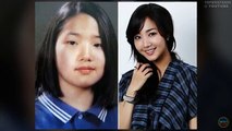 Coreano el plastico cirugía antes de y después de la fotos