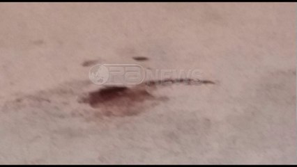 Ora News – Vlorë, atentat pranë Lungomares, ekzekutohet një person me biçikletë