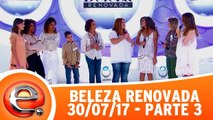 Beleza Renovada - 30.07.17 - Parte 3