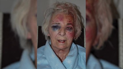 Police Hunt Woman Who Strangled 82-Year-Old With Dog Lead
