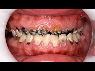15 Shocking Facts About Teeth