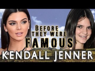 Kendall Jenner - Before They Were Famous