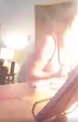 Texas Woman Burnt by Candles Flames