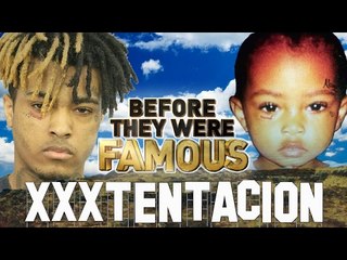 XxxTENTACION - Before They Were Famous - Jahseh Onfroy