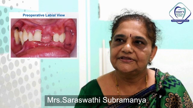 Dental Implant Testimonial - Full Mouth Rehabilitation