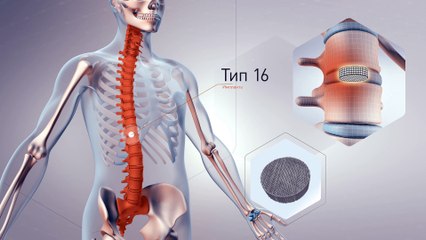 эксплейнер видеореклама производство имплантов explainer презентация нового продукта