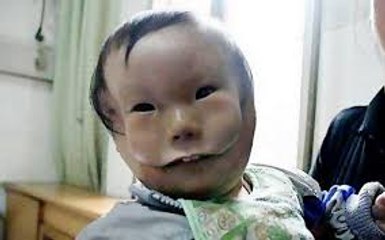 Top 10 People With Extra Body Parts