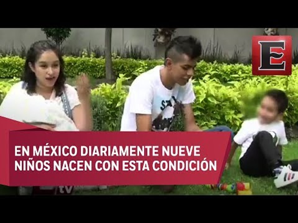 ¿Por qué los bebés nacen con labio leporino y/o paladar hendido?