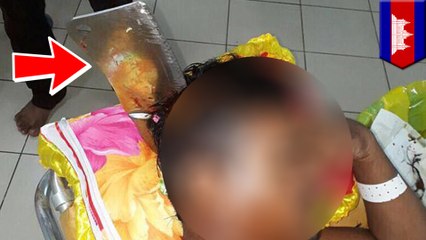 Meat cleaver thrown through window lands in man's head