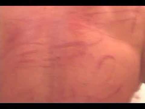 TNA: Exclusive Video Of Jeff Jarrett's Back